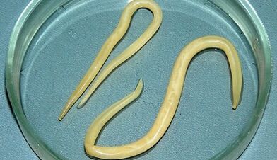 Comment passer correctement les tests de l'ascariase